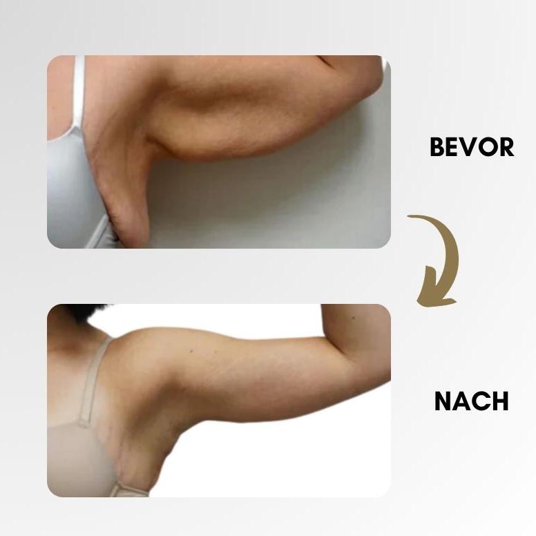 Lymphsystemanregungsring
